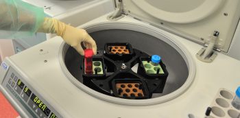 conservation des dons d'ovocytes et de spermatozoïdes dans une machine