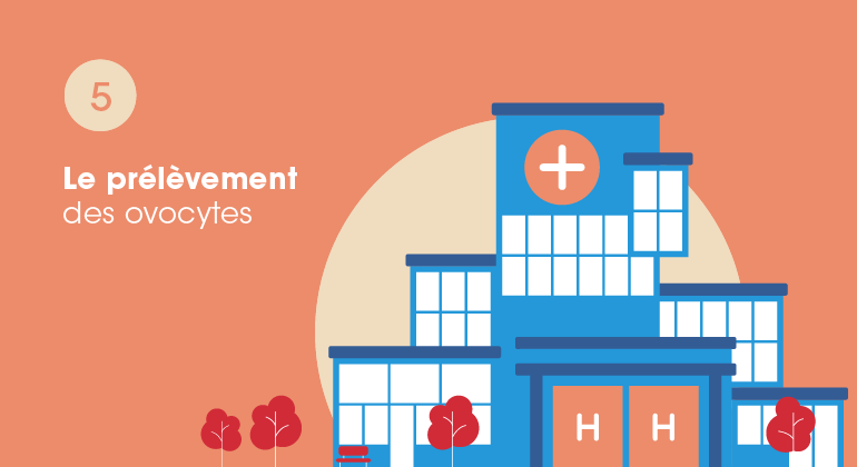 Illustration d'un hôpital pour la phase de prélèvement des ovocytes